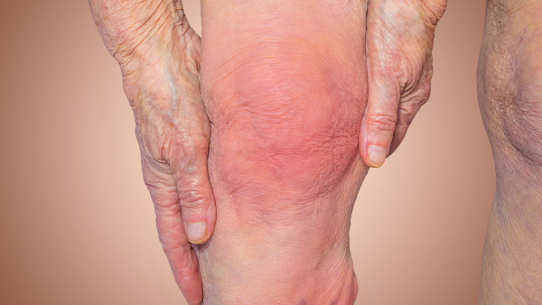 膝盖各个部位疼痛图解 膝盖的不同位置疼痛怎么缓解