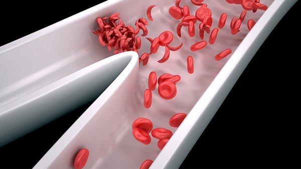 血红蛋白偏高是什么原因 血红蛋白偏高少吃什么